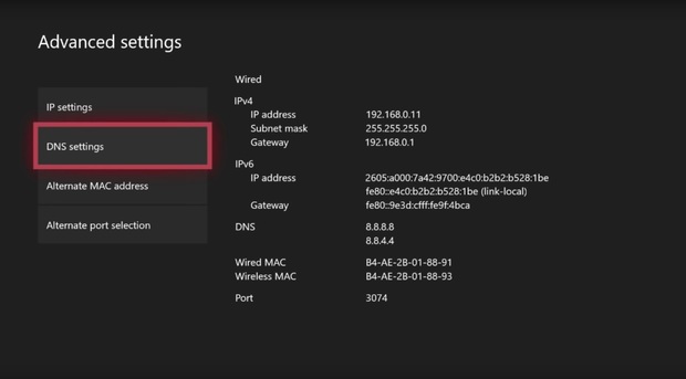 آموزش تنظیم DNS در ایکس باکس